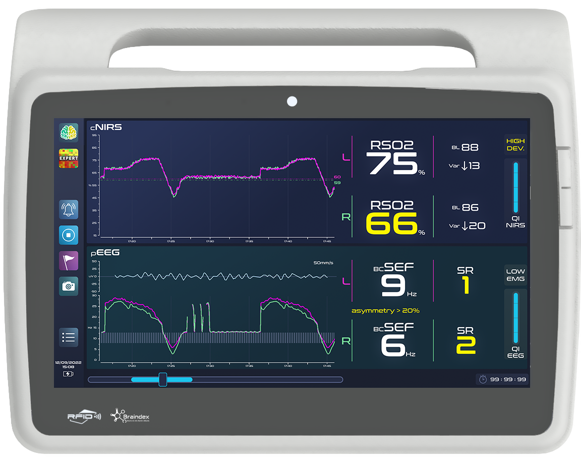 Braindex - SMART INTEGRATED BRAIN MONITORING PLATFORM